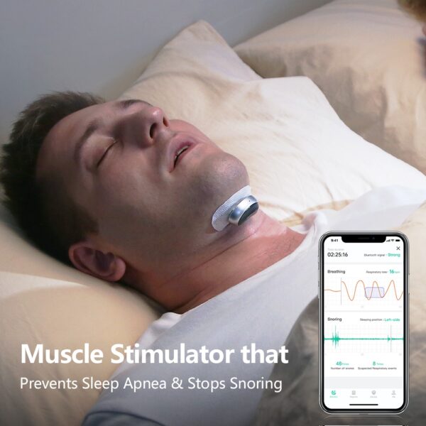 Smart Anti Snoring Device Electronic Muscle Stimulator Pro - Image 5