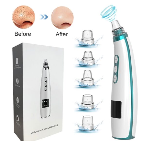 Electric Black Head Suction Instrument Face Cleaner - Image 3