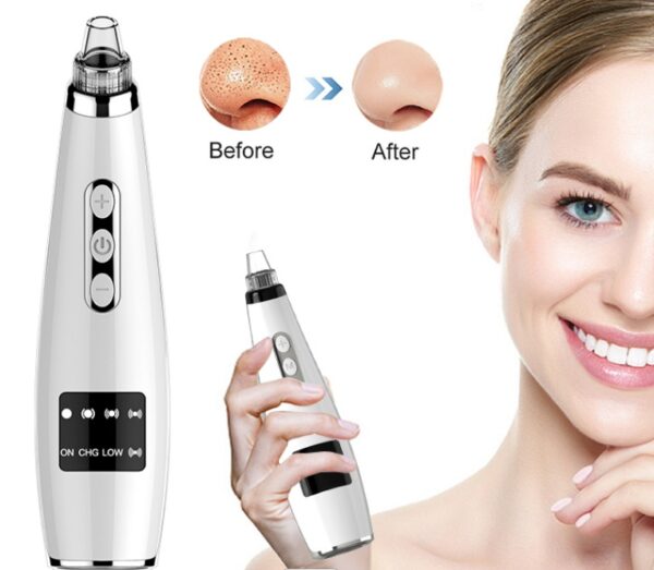 Electric Black Head Suction Instrument Face Cleaner - Image 2