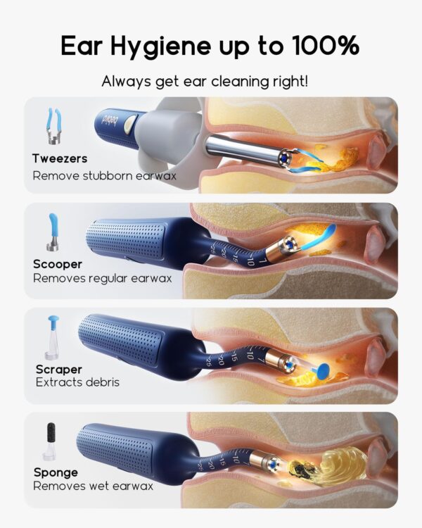 Smart Wireless Endoscope Earpick Suit - Image 3